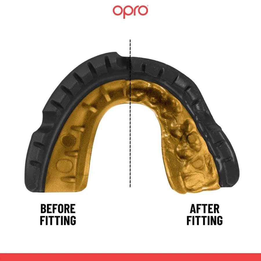 OPRO UFC GOLD BRACES - Gebitsbeschermer voor Beugel